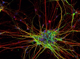 Показано, что нейроны у людей с аутизмом растут иначе