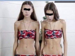 «Были живыми трупами»: Известные модели-близнецы из России добились выздоровления