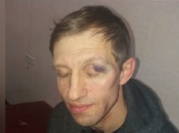 Избиение физрука в Киеве: появились фото избитого учителя