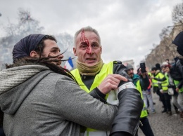 В Париже фотографу, снимавшему "желтых жилетов", из-за взрыва гранаты оторвало кисть