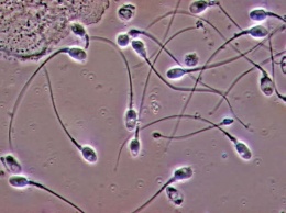 Показано, как женский организм отбирает самые быстрые сперматозоиды