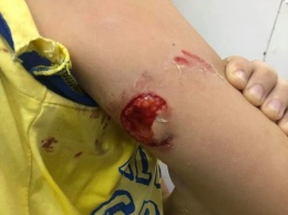 В Николаеве в детском развлекательном центре рухнули качели - травмировался ребенок