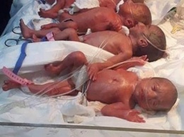 Ни один из семерых близнецов, родившихся в Ираке, не выжил