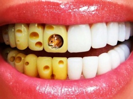 Обнаружена прямая связь между проблемными зубами и риском развития рака