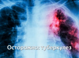 Что такое туберкулез и как его избежать: причины, симптомы, профилактика