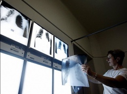 В Чехии наблюдается рост заражения туберкулезом. Болезнь завозят в том числе украинские заробитчане