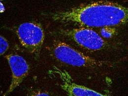 Новый метод поможет "увидеть", как и чем питается раковая клетка