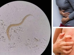 5 признаков, что в вашем теле могут жить паразиты