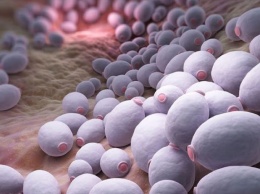 6 признаков того, что ваш организм убивает грибок кандида: рецепт натурального средства