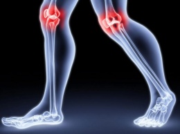 Болят суставы: причины появления артроза после 30 лет