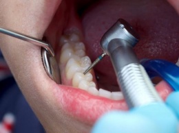 Зубные пломбы в большинстве случаев не нужны