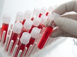 В США ученые придумали, как сдать анализ крови без ее забора