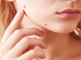 Факторы риска рака кожи