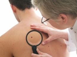 Где в Мелитополе можно пройти бесплатное обследование на рак кожи