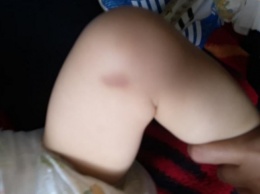 Инцидент в Запорожье: В детской больнице на ребенка упал умывальник (ФОТО)