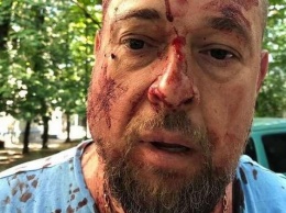 Кастетом по голове: в Харькове избили активиста Нацкорпуса (фото 18+)