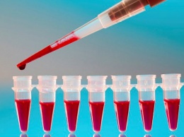 Прозрачный пластырь из клеток крови защитит диабетиков от ампутаций