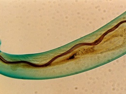 На Гавайях обнаружены опасные для мозга паразиты