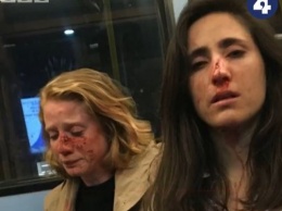 Требовали показать лесби-шоу. В автобусе Лондона подростки до крови избили двух девушек
