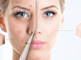 Как правильно очищать кожу лица