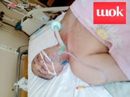 В реанимации в Кривом Роге находится мужчина без сознания, зверски избитый на БМВ 30 мая