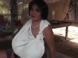 Женщину доканывает гигантский бюст, врачи разводят руками