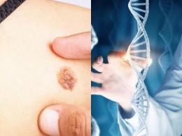 Найден белок, связанный с геном рака кожи