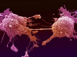 «Троянский конь»: ученые заявили о создании бактерий для борьбы с раком