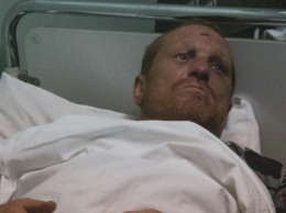 В Киеве ирландец почти месяц жил на улице, просил еду у прохожих и хотел умереть