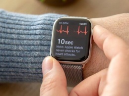 Кардиологи рассказали о главной проблеме функции ЭКГ в Apple Watch