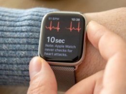 Врачи-кардиологи раскритиковали функцию ЭКГ в Apple Watch 4