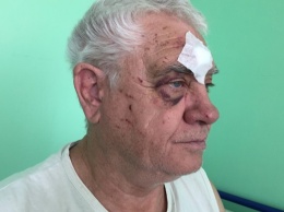 В Харькове коп избил пенсионера за просьбу уступить место в трамвае - СМИ