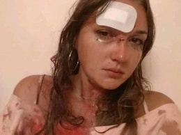 В одесском клубе "Трумен" избили девушку: администрация "отморозилась", в полиции "улыбаются"