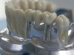 Ученые раскрыли метод формирования роста новых зубов