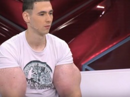 Кириллу Терешину становится хуже, но врачи отказываются удалять его «руки-базуки»