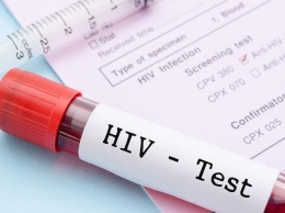 В Мелитопольском районе две сотни носителей ВИЧ