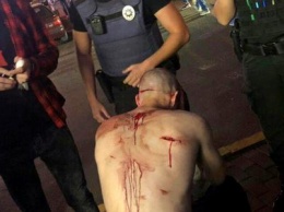 В Днепре возле ТЦ "МОСТ-сити" мужчину порезали ножом