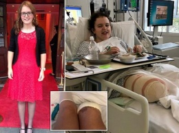 Девушка отрезала ногу из-за постоянных болей