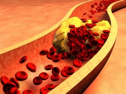 Употребление фруктов, овощей, сахара, специй и чеснока снижает уровень "плохого" холестерина