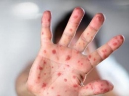 В Пакистане бушует эпидемия лихорадки, пострадавших 20 тыс