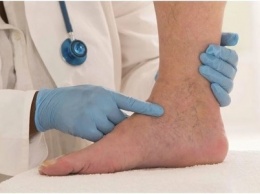 Тромб в ноге: не пропустить первые симптомы