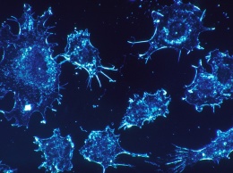 Клетки раковых опухолей могут посодействовать в лечении