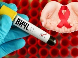 Новый штамм ВИЧ появится в России? Медики рассказали, чем это грозит россиянам