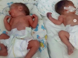 Стало известно о состоянии двойняшек, которых 15-летняя жительница Запорожья родила раньше срока