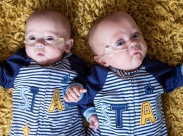 Британка родила наименьших в мире близнецов