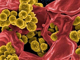 Создана новая вакцина от Staphylococcus aureus с эффективностью в 80%