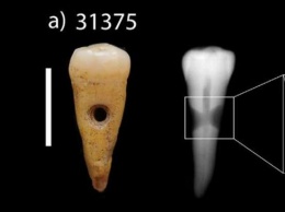 В Турции найдены древние украшения из человеческих зубов