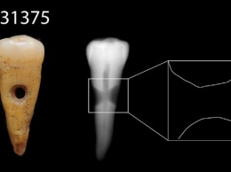 В Турции найдены украшения из человеческих зубов