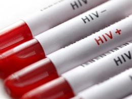 ВИЧ-позитивные украинцы требуют лекарств под ОП: Минздрав провалил закупку