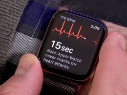 Врач-кардиолог подал на Apple в суд из-за функции ЭКГ в Apple Watch